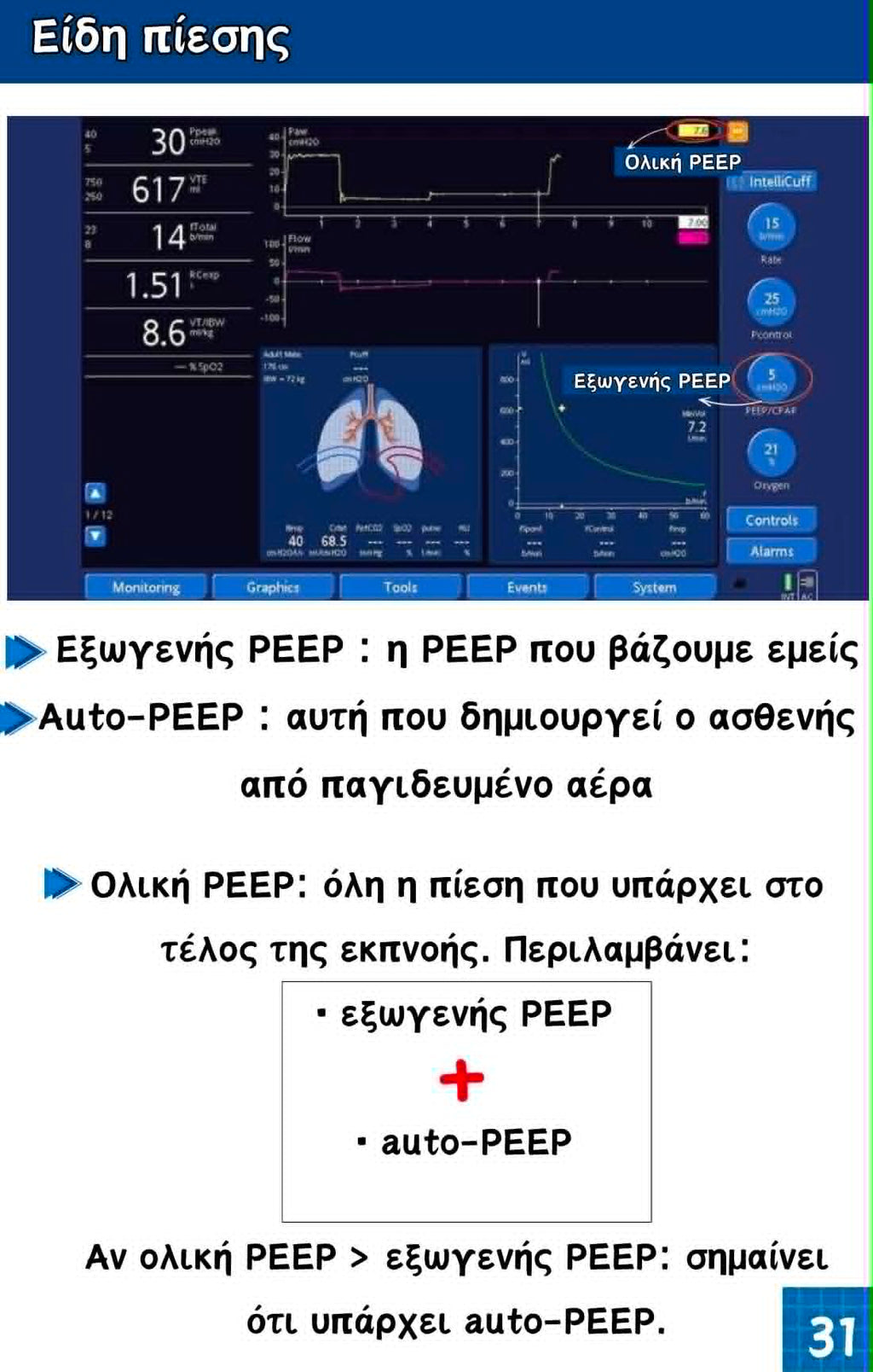 Κλινικός Oδηγός Mηχανικού Aερισμού