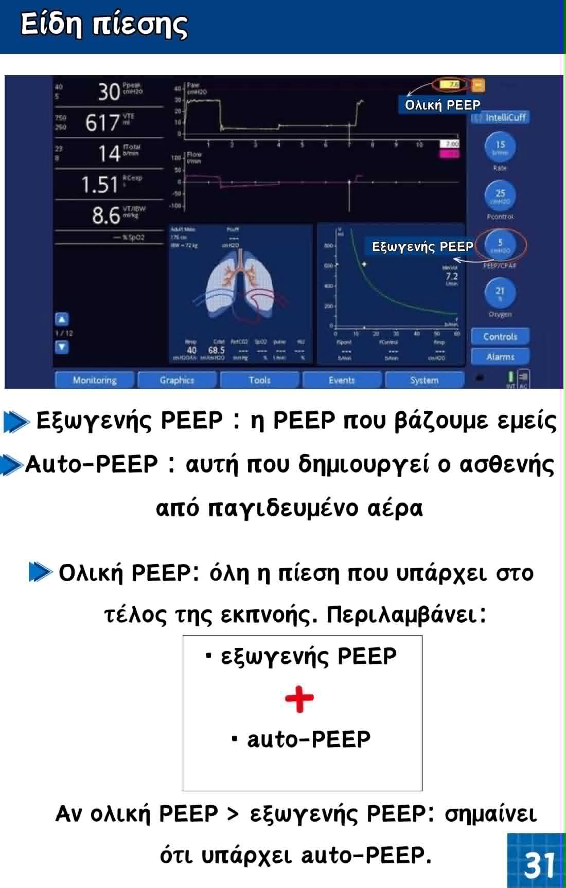 Κλινικός Oδηγός Mηχανικού Aερισμού