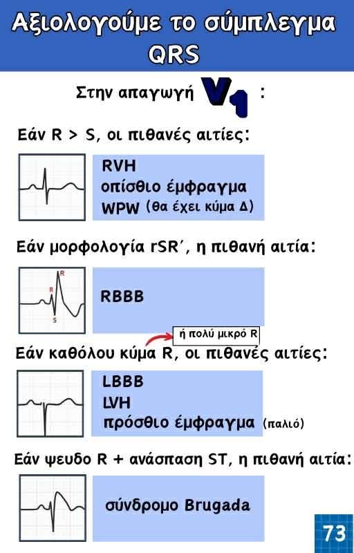 Κλινικός Οδηγός ΗΚΓ