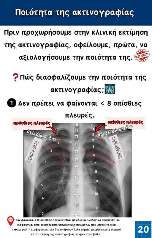 Κλινικός Οδηγός Ακτινογραφίας Θώρακος