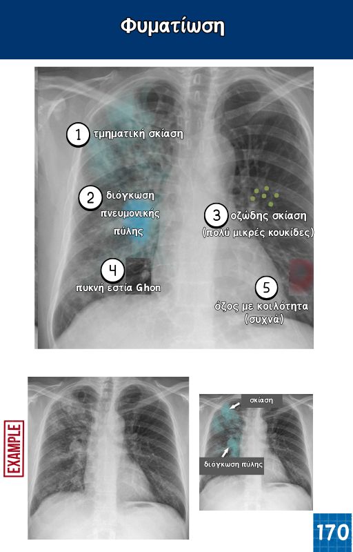 Κλινικός Οδηγός Ακτινογραφίας Θώρακος