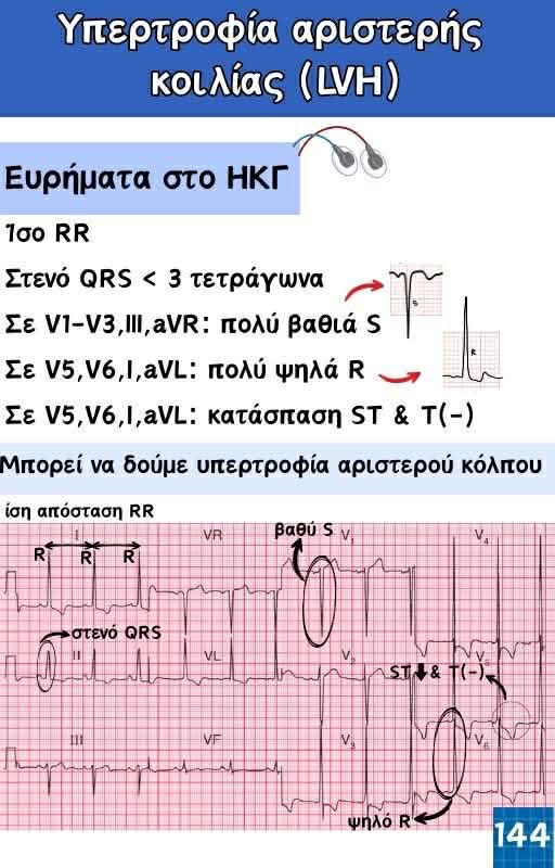 Κλινικός Οδηγός ΗΚΓ